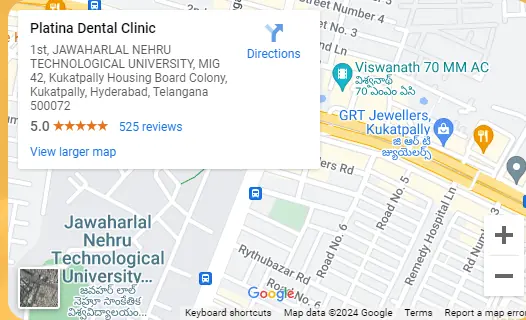 Platina Dental Clinic KPHB Kukatpally